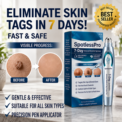 SpotlessPro Advanced Skin Care Pen